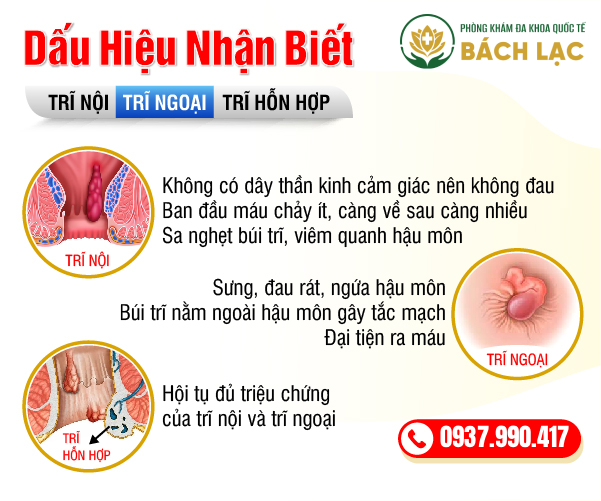 Cách Nhận Biết Dấu Hiệu Bệnh Trĩ Nội Và Trĩ Ngoại