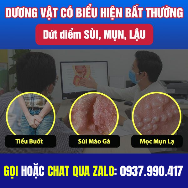 Khám chữa dương vật nổi mụn ở đâu Đắk Lắk tốt? 