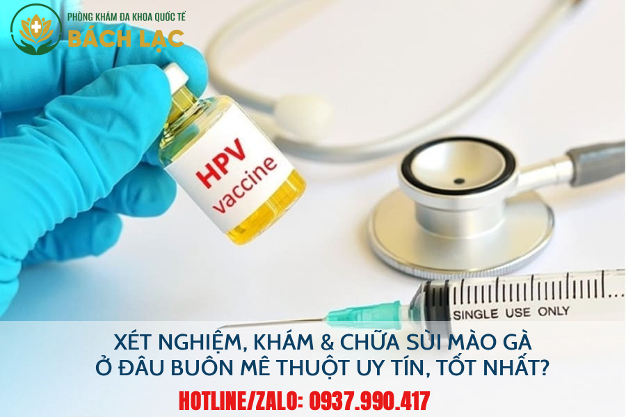Xét Nghiệm Sùi Mào Gà Ở Đâu Đắk Lắk Tốt Nhất? 