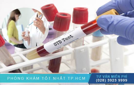 Gợi ý địa chỉ xét nghiệm bệnh xã hội nhanh và chính xác tại quận 5