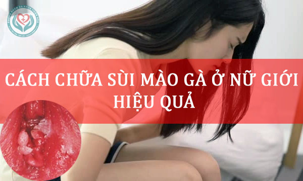 Top 3 cách chữa sùi mào gà ở nữ giới hiệu quả chị em nên biết