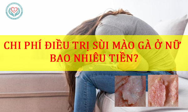 Chi phí điều trị sùi mào gà ở nữ bao nhiêu tiền?