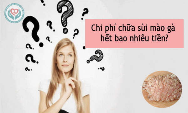 Chi phí chữa sùi mào gà hết bao nhiêu tiền?