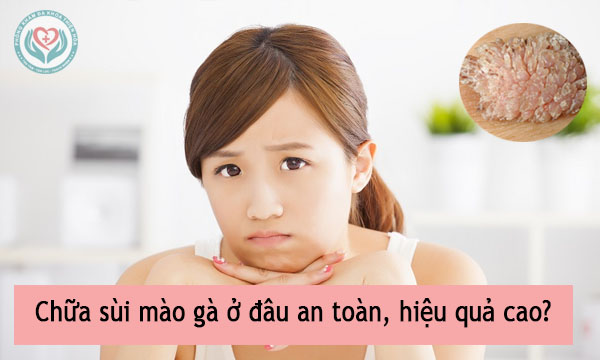 Chữa sùi mào gà ở đâu an toàn, hiệu quả cao? 