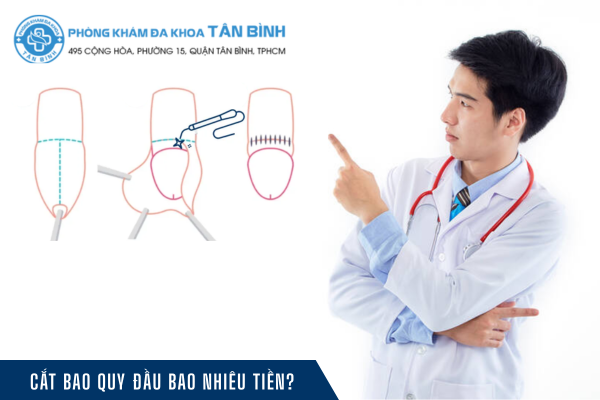 Chi phí cắt bao quy đầu ở quận 11 là bao nhiêu?