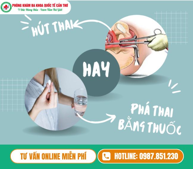 Các Phương Pháp Phá Thai An Toàn Là Gì? Địa Chỉ Phá Thai Ở Cần Thơ