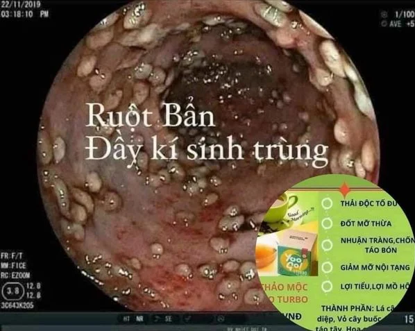 tra-thai-doc-dai-trang-yoogo-4.png?v=1