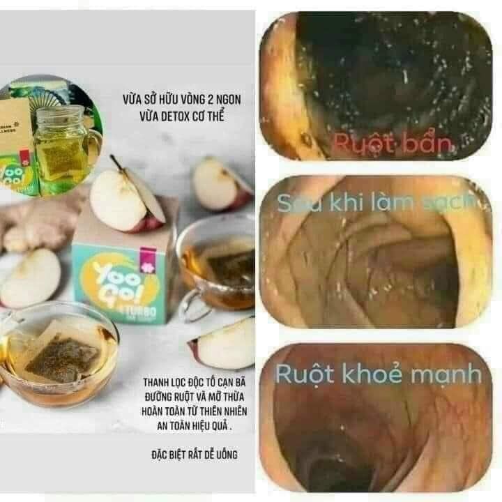 tra-thai-doc-dai-trang-yoogo.jpg?v=1