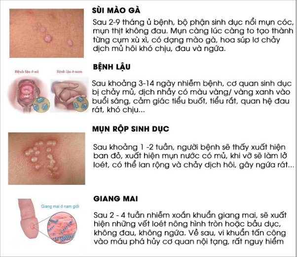 benh-xa-hoi.jpg?v=1764129569027