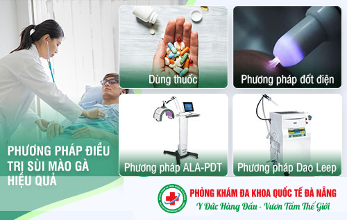 Khám Sùi Mào Gà Quảng Ngãi Cơ Sở Nào Tốt? Địa Chỉ Phòng Khám Bệnh Xã Hội Quảng Ngãi Được Yêu Thích Nhất