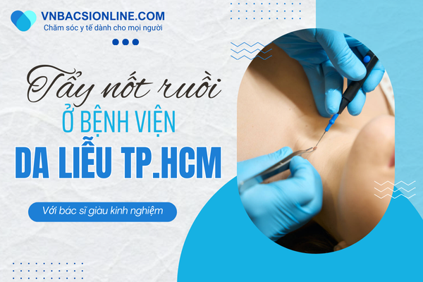 Có nên tẩy nốt ruồi ở Bệnh viện Da liễu TPHCM không?