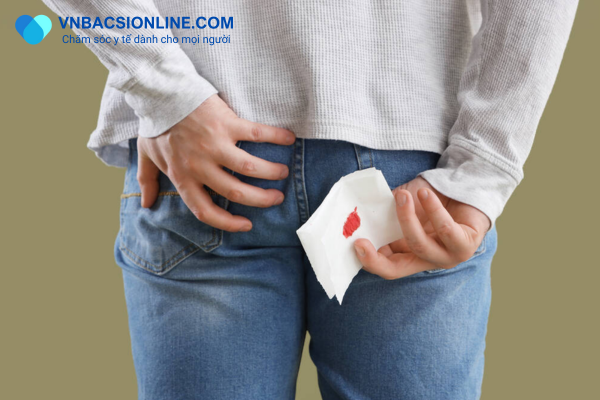 tổng quan về địa chỉ khám trĩ ở đâu