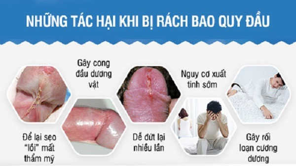 Hậu quả khi nam giới bị rách bao quy đầu