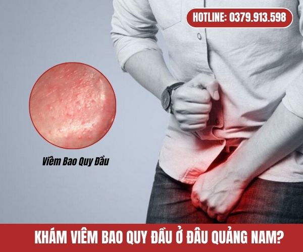 Nam Giới Khám Viêm Bao Quy Đầu Ở Đâu Uy Tín, Tốt Nhất?