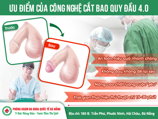 công nghệ cắt bao quy đầu ở Đà Nẵng