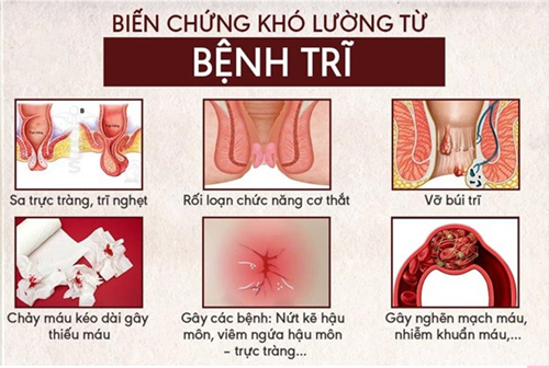 Top 9 Địa chỉ phòng khám bệnh trĩ ở đâu tốt nhất tại Hà Nội