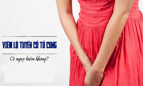 Top 8 địa chỉ chữa viêm lộ tuyến cổ tử cung ở đâu tốt nhất tại Hà Nội