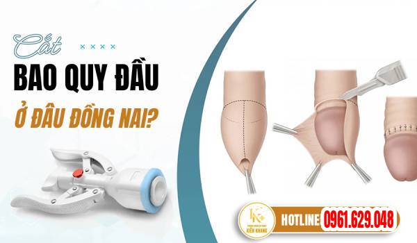 Nam Giới Nên Chọn Cắt Bao Quy Đầu Ở Đâu Đồng Nai Tốt Nhất?