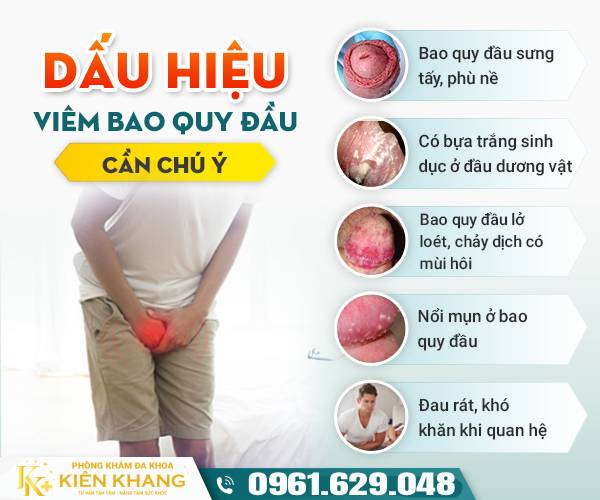 Dấu hiệu viêm bao quy đầu: Nhận biết sớm triệu chứng để tránh biến chứ