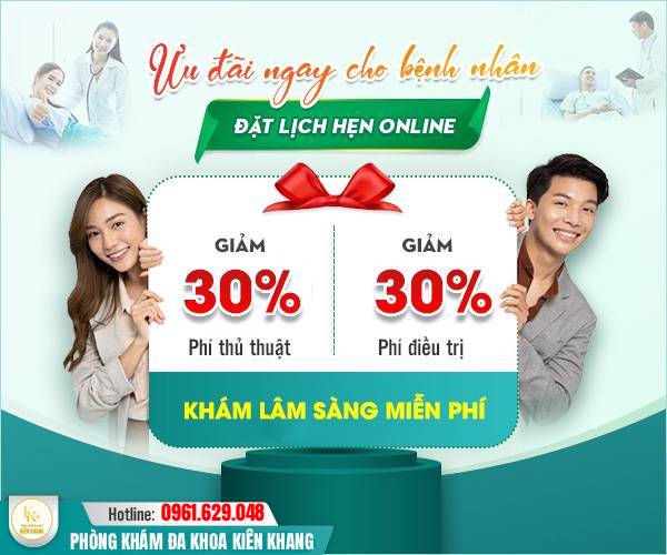 uu-dai-30-chi-phi.jpg?v=1771853056610